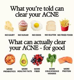 Tired of harsh topical treatments? Explore the power of your plate! This guide dives into foods rich in essential nutrients that can help combat acne from the inside out, promoting clearer and healthier skin. Foods And Benefits, Foods That Prevent Acne, Foods That Age You, Foods That Are Bad For Your Skin, How To Reduce Cravings, Foods That Trigger Acne, Foods That Help Skin, Food That Helps With Acne, Foods To Eat For Bigger 🍒