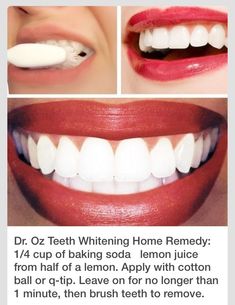 teeth whitening home remedy Lemon And Baking Soda, Lemon Juice And Baking Soda, Baking Soda Lemon Juice, Baking Soda And Lemon, Brush Teeth, Oil Pulling, Makeup Tricks, Beauty Remedies, Q Tip