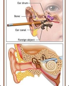 an ear is shown with the parts labeled in it and there are two different types of ear