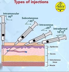 the diagram shows different types of injections