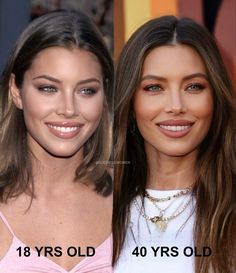 Age is a tricky thingWe can look at one person and think they're Nose Plastic Surgery, Celebrity Surgery, Rhinoplasty Nose Jobs, Fashion Journalism, Botox Before And After, Rhinoplasty Before And After, Eyebrow Lift, Celebrity Plastic Surgery