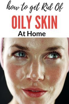 Remedies For Oily Skin, Oily Skin Remedy, Skin Care Home Remedies, Natural Face Wash, Tips For Oily Skin, Oily Skin Acne, Best Face Wash, Acne Problem, Moisturizer For Oily Skin