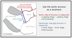 a diagram showing the location of an area in which there are several different types of landforms