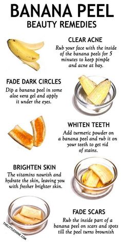 Natural Skin Care Remedies, Resep Diet, Makijaż Smokey Eye, Beauty Remedies, Skin Remedies