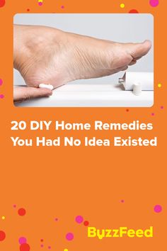 Mosquito Bites, Leg Cramps, Mosquito Bite, You Have No Idea, Home Remedies, The Internet, Home Diy, Internet