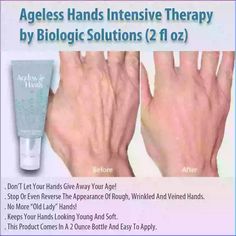 #AgelessHands #IntensiveTherapy #BiologicSolutions #HandCare #AntiAging #SkinCare #HandTreatment #MoisturizingCream #HealthySkin #NourishingCare #LuxurySkinCare #AgeDefying #HandCream #BeautyProducts #DermatologistRecommended #SkinRejuvenation #AntiWrinkle #HydratingFormula #SkinHealth #PersonalCare Natural Wrinkle Remedies, Antiaging Skincare, Wrinkle Remedies, Dermatologist Recommended, Age Defying, Hand Care, Look Younger