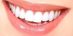 Perfect Teeth, Best Teeth Whitening, White Smile, Stained Teeth, Natural Teeth Whitening, Natural Teeth