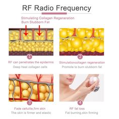 V Line Face, Face Machine, Ultrasonic Cavitation, Slimmer Face, Skin Dryness, Skin Tissue, Wrinkled Skin, Red Led