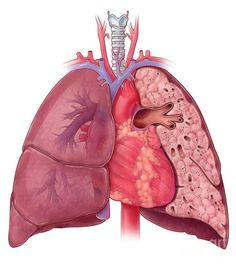 an illustration of the human heart and lungs