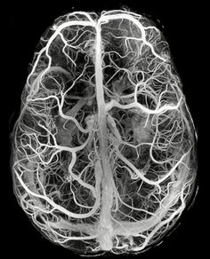 the human brain is shown in black and white