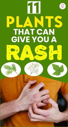 11 Plants That Can Give You A Rash: They can cause rashes, inflammation, or trigger severe allergic reactions. To avoid such unfortunate events, we at Stylecraze made a list of some common outdoor plants you may encounter on a field trip. The pictures will help you identify the leaves and keep you safe on your next jungle hike. #rash #plants #hike #health #wellness #poisonivy Poison Oak Rash Pictures, Poison Ivy Rash Pictures, Allergic Reaction Rash, Poison Oak Rash, Poison Ivy Rash, Swollen Eyelid, Fall Allergies, Jungle Hike, Sinus Pain