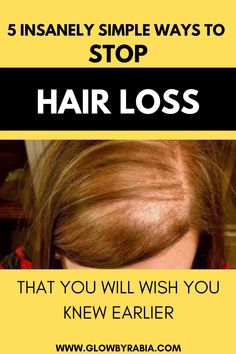 Thinning Hair Remedies, Brown Spots On Face, Boost Hair Growth, Home Remedies For Hair, Regrow Hair, Hair Healthy, Hair Control, Hair Growth Faster, Lost Hair