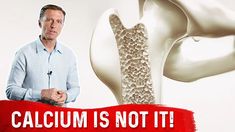 Reverse Osteoporosis, Osteoporosis Diet, Osteoporosis Exercises, Osteoporosis Prevention, Calcium And Vitamin D, Bone Strengthening, Calcium Deficiency, Coronary Artery, Dr Eric Berg