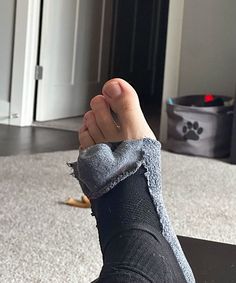 a person's foot with a cast on it