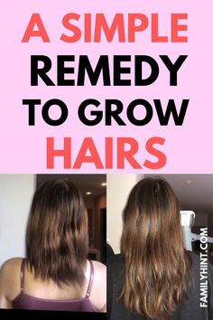 Tips For Long Hair, Ways To Grow Your Hair, Hair Is Falling Out, Help Hair Grow Faster, Fast Natural Hair Growth, Ways To Grow Hair, Grow Hair Long, How To Grow Hair Faster, Regrowth Hair