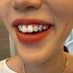 a woman with braces on her teeth smiles at the camera while wearing a necklace