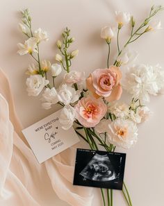 a bouquet of flowers with an x - ray card on the table next to it