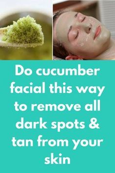 Do cucumber facial this way to remove all dark spots & tan from your skin Today in this article I will tell how to use cucumber to get instant glow on your face. Apart from glowing skin this facial will also remove all dark spots & tanning from your face, in just 1 treatment of this natural facial you can see the difference in your skin. Before proceeding to our … Remove Tan From Face, Black Spots On Face, Sunspots On Face, Spots On Forehead, Brown Spots On Hands, Brown Age Spots, Brown Spots On Skin, Dark Spots On Face, Brown Spots Removal