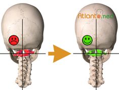 Corrección del Atlas Occipital Neuralgia, Cervical Spondylosis, Spinal Nerve, Trigger Point Therapy, Stiff Neck, Neck Pain Relief, Health Heal, Trening Abs