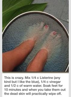 Dead Skin Foot Bath Listerine Foot Soak, Foot Soak Recipe, Foot Soak, Beauty Remedies, Homemade Beauty Products, Health And Beauty Tips, Beauty Treatments, Dead Skin, Diy Beauty