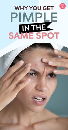 Cure Pimples Hormonal Cycle, Pimples On Face, How To Get Rid Of Pimples