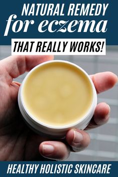 How to make an eczema treatment that works. This eczema relief balm recipe uses ingredients that soothe inflammation, itching and dryness. Botanical Apothecary, Herbal Medicine Cabinet, Balm Recipe, Holistic Skin Care, Homemade Beauty, Natural Skin Care Routine, Natural Therapy, Natural Remedy, Skin Care Recipes