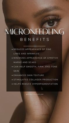 Micro Needling Benefits, Microneedling Aesthetic, Microneedling Benefits, Spa Content, Benefits Of Microneedling, Microdermabrasion Benefits, Aesthetic Treatments, Esthetician Inspiration