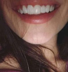 Crest Teeth Whitening Strips, Teeth Aesthetic, Pretty Teeth, Beautiful Teeth, Straight Teeth, Perfect Teeth, Teeth Whitening Strips, Smile Teeth, White Smile