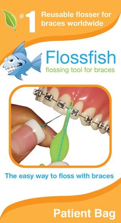 PRICES MAY VARY. The FlossFish is reusable The FlossFish is fast and easy. Cut your flossing time in half with the FlossFish The FlossFish is cost effective because it is durable and reusable! 1 FlossFish will last for months unlike other products that have a 1 time use. The FlossFish is an earth friendly option. Other products have a one time use and clog up landfills. The FlossFish makes flossing with braces easy. Please look at the videos in the product description below People With Braces, Braces Tips, Getting Braces, Dental Floss Picks, Gum Recession, Brace Face, Braces Colors, Teeth Braces, Best Teeth Whitening