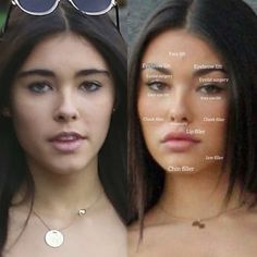 Madison Beer plastic surgery surgery before and after, natural face without makeup and surgery. 2020,2021,2022,2023 plastic surgery analysis breakdown Eyebrow Lift Surgery, Botox Lip Flip, Filler Face, Foxy Eye, Lip Flip, Lip Surgery, Cheek Implants, Chin Filler