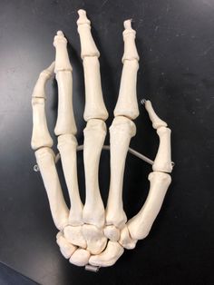 an x - ray view of the bones of a human hand