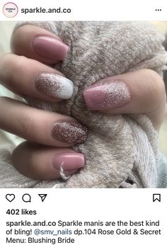 Dipped Nails Ideas Winter Ombre, Dipped Nails Ideas Winter, Dipped Nails Ideas, Nails Ideas Winter, Glitter Gel Nail Designs, Color For Nails, Pretty Toe Nails, Glitter Gel Nails, Nail Salons