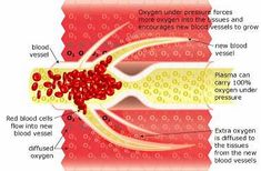 The Science • Advanced Hyperbaric Recovery, Inc Atmospheric Pressure, Blood Plasma, Medical Facts, Health Heal, Body Fluid, White Blood Cells