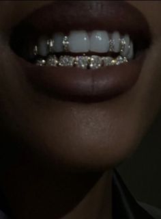 Pretty Teeth, Diamond Teeth, Grills Teeth, Tooth Gem, Gold Teeth, Teeth Jewelry, Jewelry Accessories Ideas