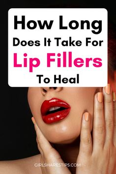 Lip Injections Juvederm, Before And After Lip Fillers, Lip Filler Shape Ideas, Natural Lip Fillers, Lip Filler Inspiration, After Lip Fillers, Filler Inspiration, Filler Aftercare