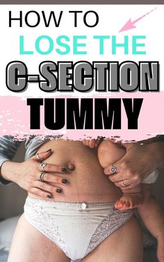 New mom losing her postpartum belly after a c-section Mom Pouch Outfits, Post C Section Exercise, C Section Pouch, Post Partum Belly, Mom Tummy, Pooch Workout