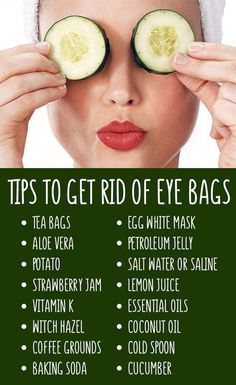 Get Rid Of Eye Bags, Rid Of Eye Bags, Remove Eye Bags, Eye Skin Care, Dark Circles Under Eyes, Under Eye Bags, Under Eyes, Beauty Remedies, Skin Care Remedies