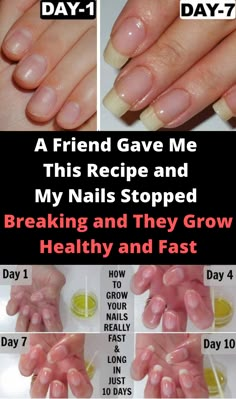 A Friend Gave Me This Recipe and My Nails Stopped Breaking and They Grow Healthy and Fast #nail #skin #beauty #beautytips #beautyrecipes Make Nails Grow, Grow Long Nails, Nail Growth Tips, Natural Nail Care, Health Signs, Tongue Health, Nagel Tips, Nail Care Tips, How To Grow Nails