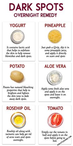 How To Clear Dark Spots On Face Overnight, Skin Care For Sunspots, Homemade Skin Care For Dark Spots, Dark Spot On Face Remedies, Diy Face Mask For Dark Spots, Sunspots On Face Remedies, Diy For Dark Spots On Face, Dark Spot Corrector Diy, Vitamin C For Dark Spots