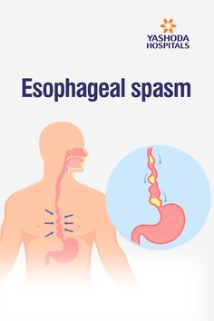 Esophageal spasm and its causes Esophagus Problems, Vocal Cord Dysfunction, Ozempic Diet, Gi Health, Crps Awareness, Lip Care Routine, Women Health Care, Human Anatomy And Physiology