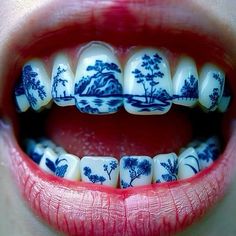 a woman's mouth with blue and white porcelain decorations on the upper part of her teeth