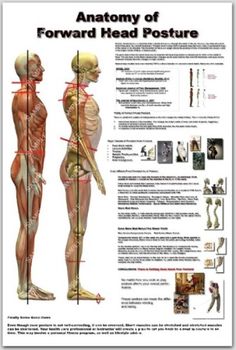 an anatomy poster showing the different muscles and their corresponding parts, including the head, neck, and arm