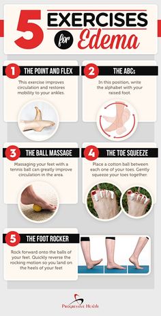 Swelling Remedies, Swollen Ankles, Cold Home Remedies, Natural Cough Remedies, Nutrition Education, Motivation Fitness