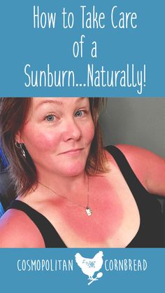 Bath For Sunburn Relief, What To Put On Sunburn Skin, Remedies For Sunburn Skin, What Helps With Sunburns, After Sunburn Care, Tips For Sunburn