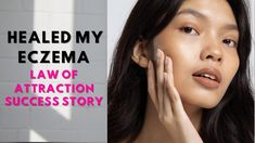 How LAW OF ATTRACTION Healed My Eczema| Law Of Attraction Manifestation ... Skin Manifestation, Desired Appearance, Manifestation Success, Attraction Manifestation, Manifestation Law Of Attraction, Success Story, Success Stories, Law Of Attraction, Physics