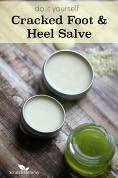 A super simple, crazy effective DIY Cracked Foot and Heel Salve Recipe which will absolutely get your feet ready for spring and summer. Get the recipe here! Healing Salves, Diy Lotion, Homemade Lotion, Homemade Bath Products, Diy Health