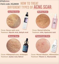 Serum For Acne, Different Types Of Acne, Pimples Under The Skin, Skin Facts, Natural Acne Remedies, Acne Scar, Types Of Acne, Skin Care Tutorial