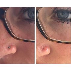 two pictures of the same person's nose and eye with glasses on top of them