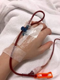 a hand with an oxygen tube attached to it