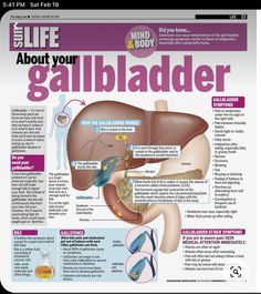 Gal Bladder Symptoms, Gallbladder Safe Foods, Essential Oils For Gallbladder Issues, Gallstone Diet Gallbladder Cleanse, Gal Bladder Diet, Recipes For Gallbladder Issues, Gallstone Diet Meals, No Gallbladder Diet Recipes, Gallbladder Diet Recipes Meals